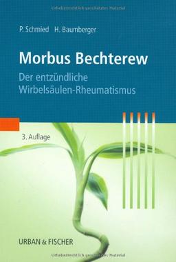 Morbus Bechterew: Der entzündliche Wirbelsäulen-Rheumatismus