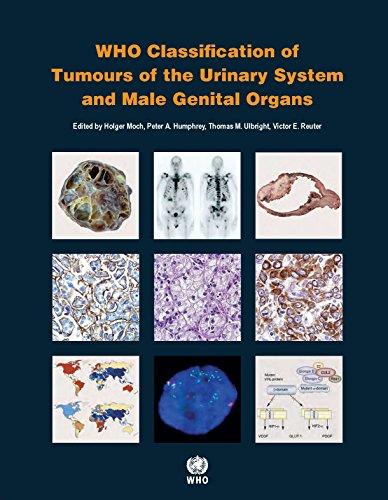 WHO Classification of Tumours of the Urinary System and Male Genital Organs (World Health Organization Classification of Tumours, Band 8)