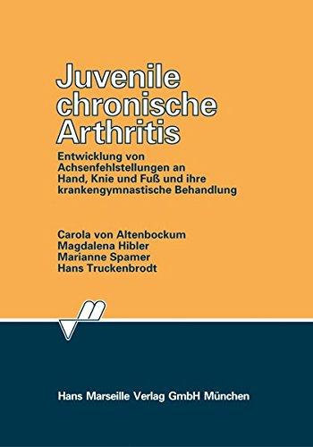 Juvenile chronische Arthritis: Entwicklung von Achsenfehlstellungen an Hand, Knie und Fuss und ihre krankengymnastische Behandlung