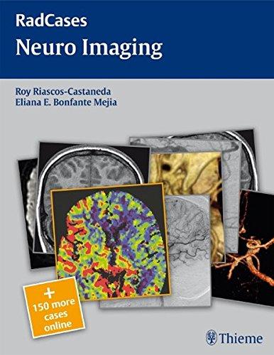 Neuro Imaging (RadCases)