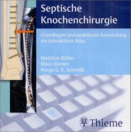 Septische Knochenchirurgie, 1 CD-ROM Grundlagen und praktische Anwendung, ein interaktiver Atlas. Für Windows 95/98/NT 4.0