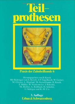 Praxis der Zahnheilkunde - PdZ. Strukturiert nach dem PermaNova-Verfahren: Praxis der Zahnheilkunde, 14 Bde. in 16 Tl.-Bdn., Bd.6, Teilprothesen