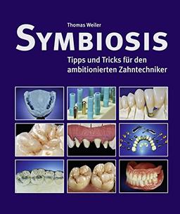 Symbiosis: Tipps und Ticks für den ambitionierten Zahntechniker