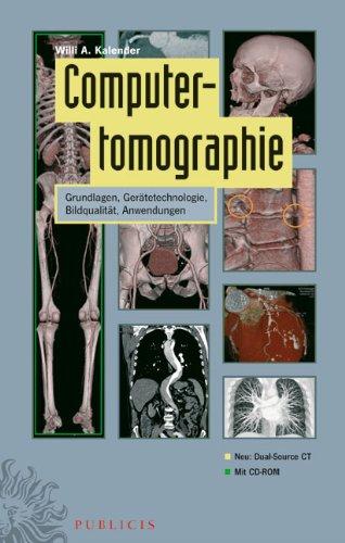 Computertomographie: Grundlagen, Gerätetechnologie, Bildqualität, Anwendungen