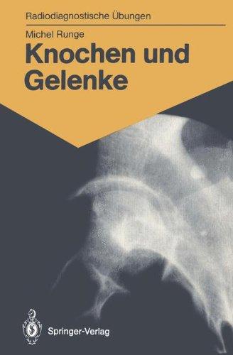 Knochen und Gelenke: 170 Diagnostische Übungen für Studenten und Praktische Radiologen (Radiodiagnostische Übungen)