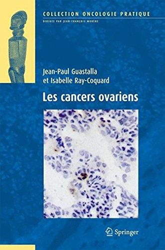 Les cancers ovariens