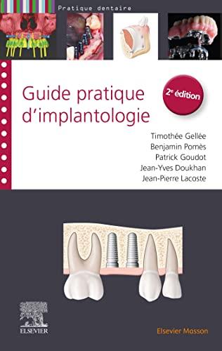 Guide pratique d'implantologie