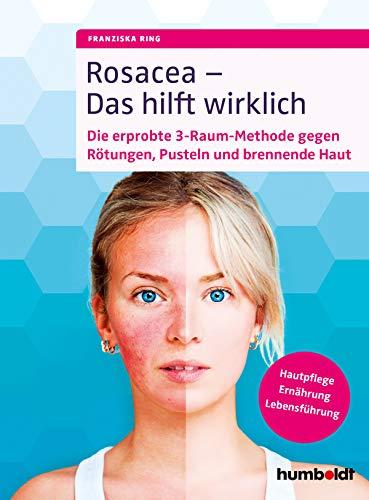 Rosacea - Das hilft wirklich: Die erprobte 3-Raum-Methode gegen Rötungen, Pusteln und brennende Haut, Hautpflege, Ernährung, Lebensführung