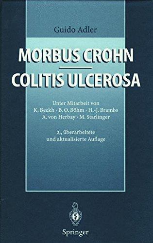 Morbus Crohn - Colitis ulcerosa