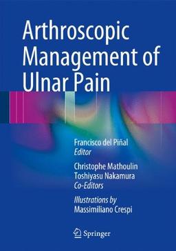 Arthroscopic Management of Ulnar Pain