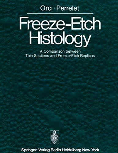 Freeze-Etch Histology: A Comparison between Thin Sections and Freeze-Etch Replicas