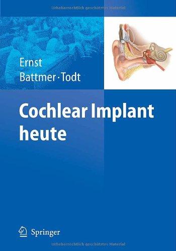 Cochlear Implant heute (German Edition)