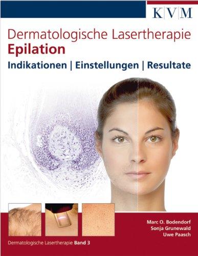 Dermatologische Lasertherapie Band 3: Epilation: Indikationen | Einstellungen | Resultate