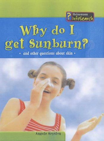 Body Matters Why do I get sunburn Paperback