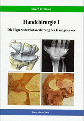 Handchirurgie: Die Hyperextensionsverletzung des Handgelenkes