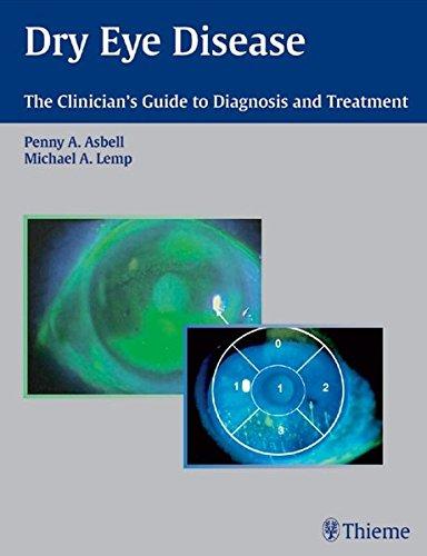 Dry Eye Disease: The Clinician's Guide to Diagnosis and Treatment