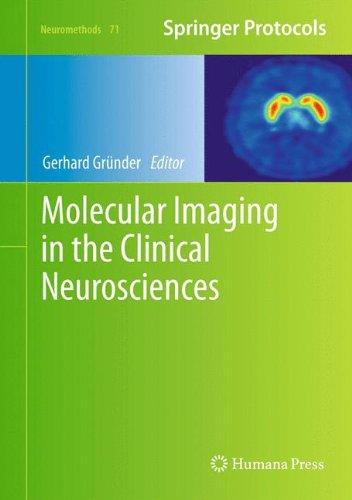 Molecular Imaging in the Clinical Neurosciences (Neuromethods)