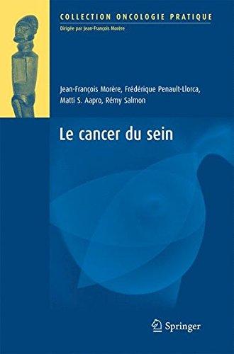 Le cancer du sein