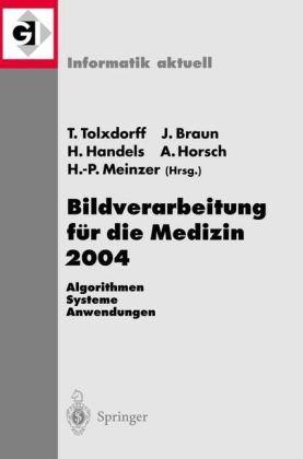 Bildverarbeitung für die Medizin 2004: Algorithmen - Systeme - Anwendungen (Informatik aktuell)