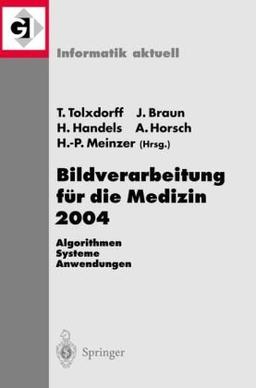 Bildverarbeitung für die Medizin 2004: Algorithmen - Systeme - Anwendungen (Informatik aktuell)