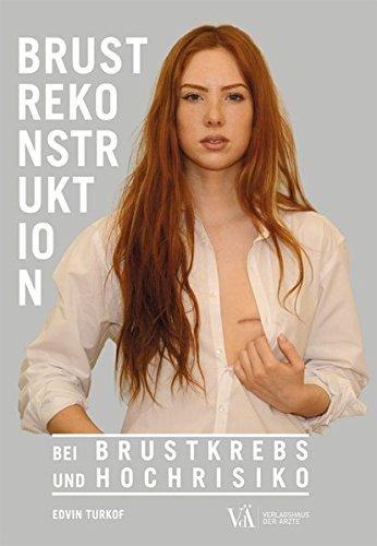 Brustrekonstruktion: bei Brustkrebs und Hochrisiko