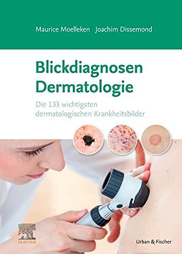 Blickdiagnosen Dermatologie: Die 133 wichtigsten dermatologischen Krankheitsbilder