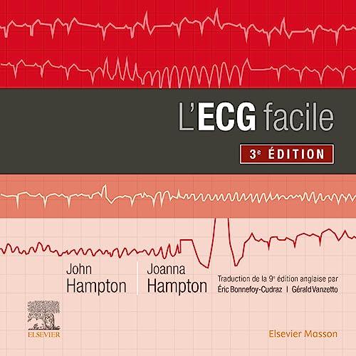 L'ECG facile