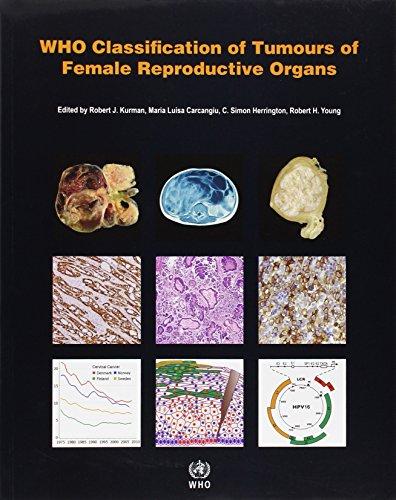 WHO Classification of Tumours of Female Reproductive Organs (World Health Organization Classification of Tumours)