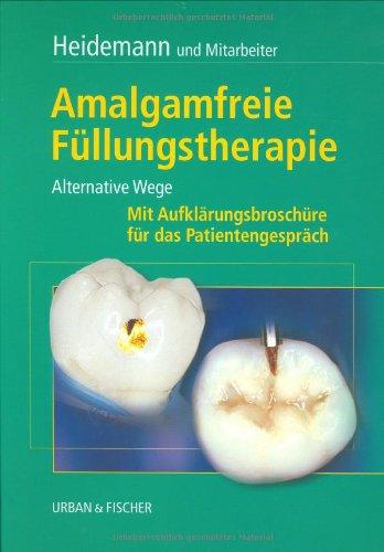 Amalgamfreie Füllungstherapie: Alternative Wege