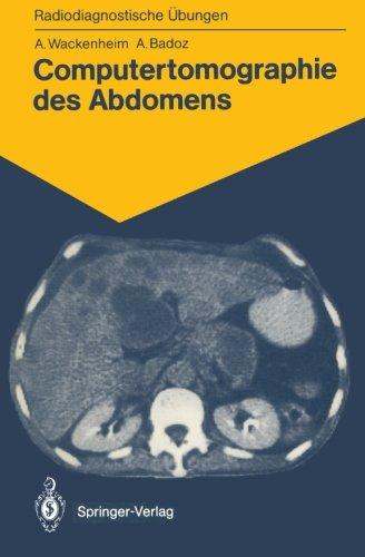 Computertomographie des Abdomens: 85 Diagnostische Übungen für Studenten und Praktische Radiologen (Radiodiagnostische Übungen)