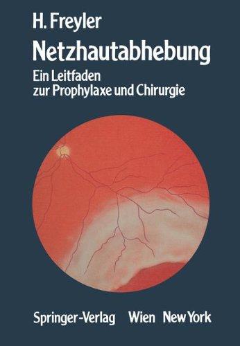 Netzhautabhebung: Ein Leitfaden zur Prophylaxe und Chirurgie