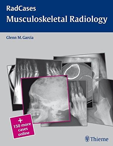 Musculoskeletal Radiology (RadCases)