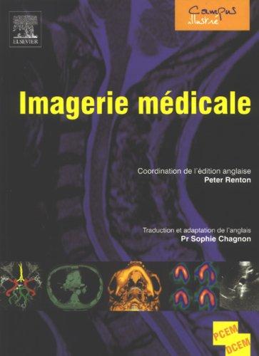 Imagerie médicale