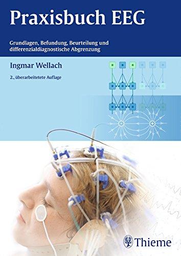 Praxisbuch EEG: Grundlagen, Befundung, Beurteilung und differenzialdiagnostische Abgrenzung