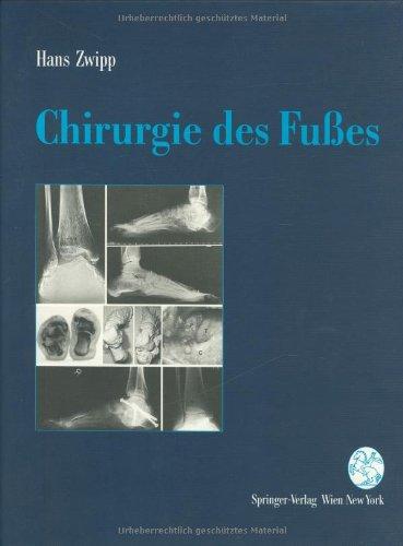 Chirurgie des Fußes