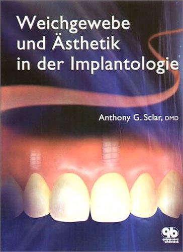 Weichgewebe und Ästhetik in der Implantologie