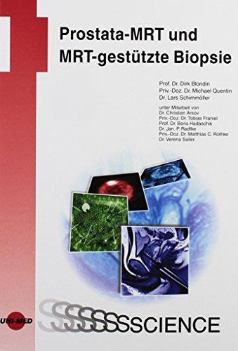 Prostata-MRT und MRT-gestützte Biopsie (UNI-MED Science)