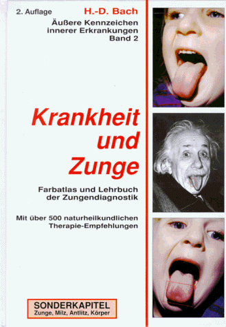 Antlitzdiagnostik: Äußere Kennzeichen innerer Erkrankungen, Bd.2, Krankheit und Zunge: Farbatlas und Lehrbuch der Zungendiagnostik. Mit über 500 ... Sonderkapitel: Zunge, Milz, Antlitz, Körper