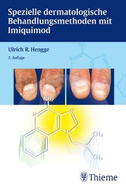 Spezielle dermatologische Behandlungsmethoden mit Imiquimod