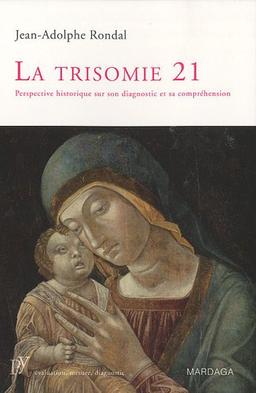 La trisomie 21 : perspective historique sur son diagnostic et sa compréhension