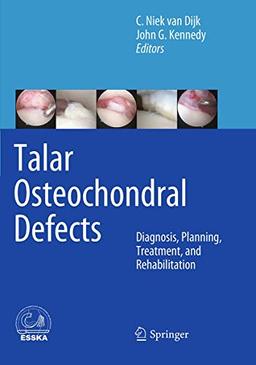 Talar Osteochondral Defects: Diagnosis, Planning, Treatment, and Rehabilitation