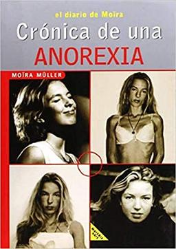 CRONICA DE UNA ANOREXIA (Materia Gris)