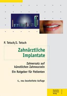 Zahnärztliche Implantate. Zahnersatz auf künstlichen Zahnwurzeln