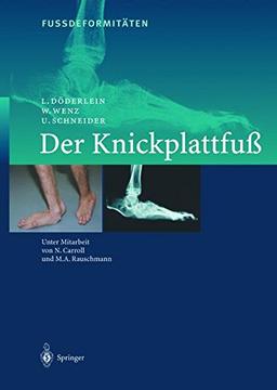 FussdeformitÄten: Der Knickplattfuss