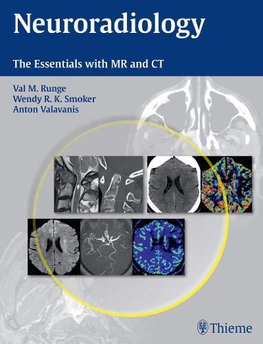 Neuroradiology: The Essentials with MR and CT