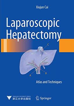 Laparoscopic Hepatectomy: Atlas and Techniques