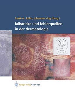 Fallstricke und Fehlerquellen in der Dermatologie