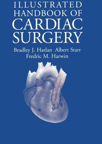 Illustrated Handbook of Cardiac Surgery (Applied Mathematical Sciences; 109)