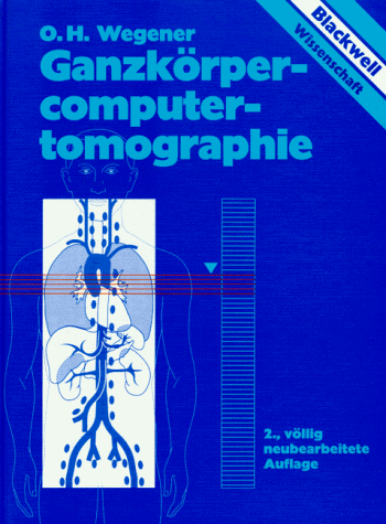 Ganzkörpercomputertomographie