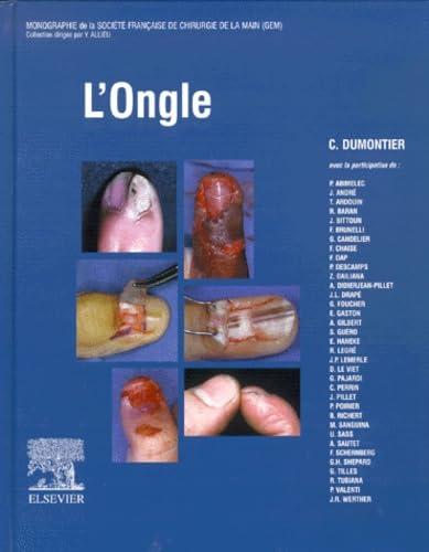 L'ongle